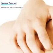 Akciğer Kanserinde Kaşıntı Olur mu