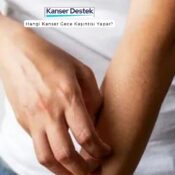 Hangi Kanser Gece Kaşıntısı Yapar