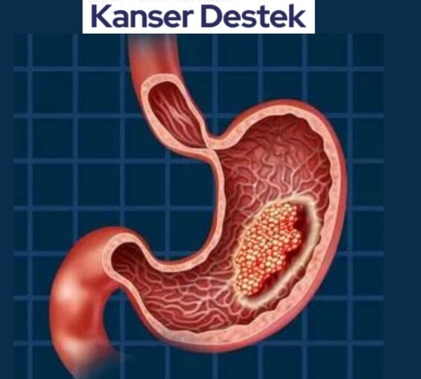 Mide Kanseri Kaç Ayda Öldürür?