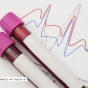 Sedimantasyon Yüksekliği ve Tedavisi