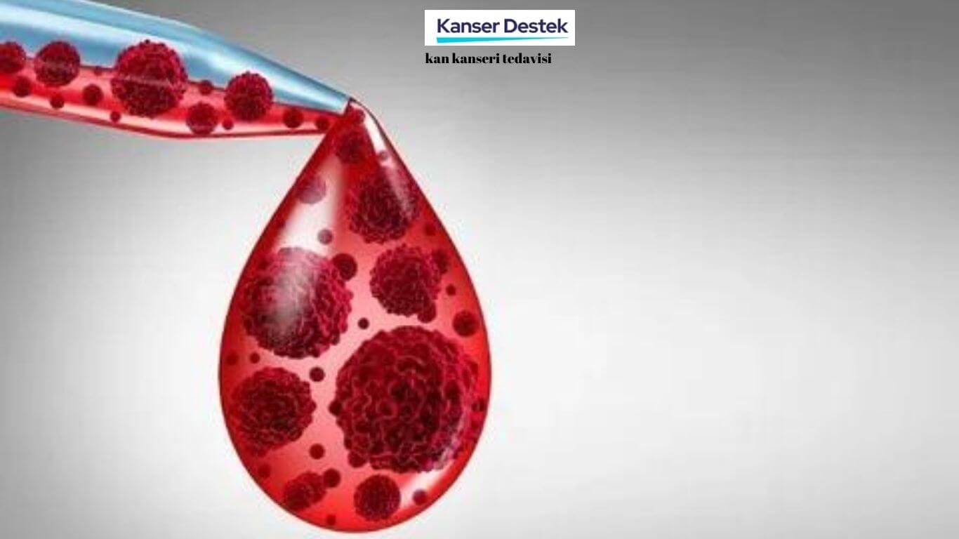 Kan Kanseri Tedavisi İçin Kullanılan 4 Yöntem!
