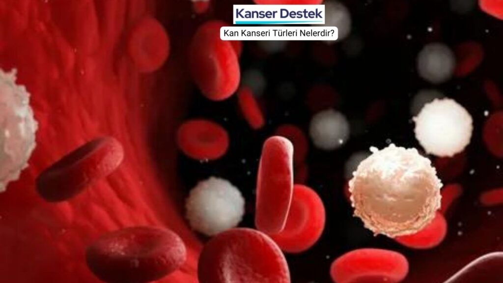 Kan Kanseri Türleri Nelerdir?