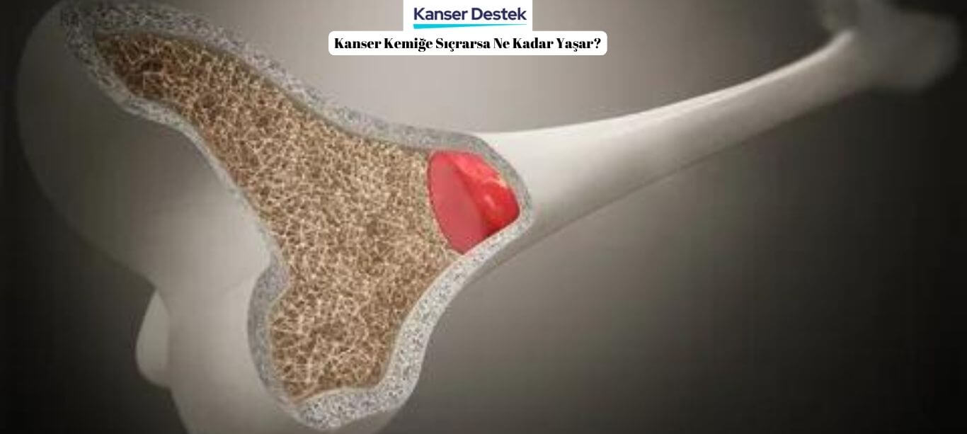 Kanser Kemiğe Sıçrarsa Ne Kadar Yaşar? İşte Konu Detayı