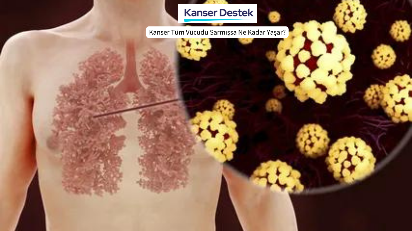 Kanser Tüm Vücudu Sarmışsa Ne Kadar Yaşar?