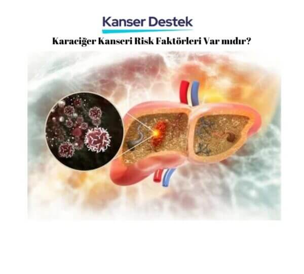 Karaciğer Kanseri Risk Faktörleri Var mıdır