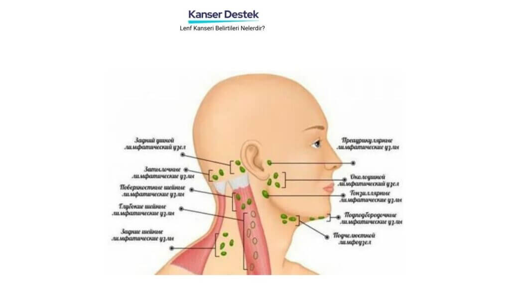 Lenf Kanseri Belirtileri Nelerdir?