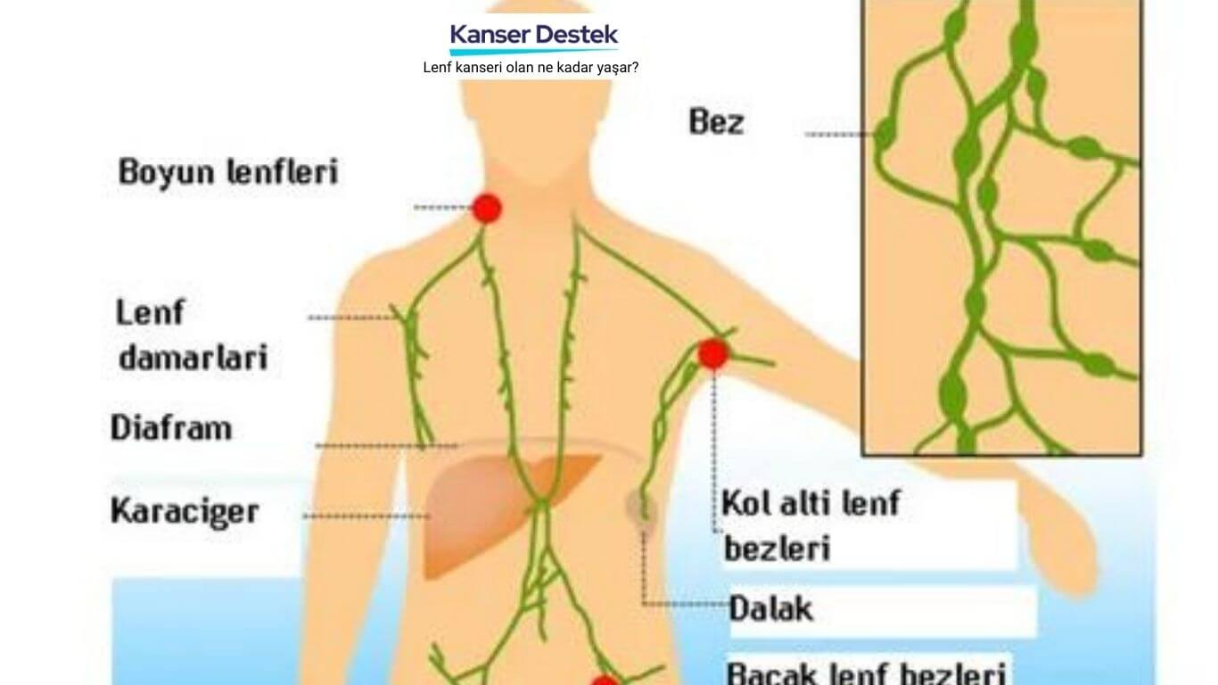Lenf kanseri olan ne kadar yaşar?