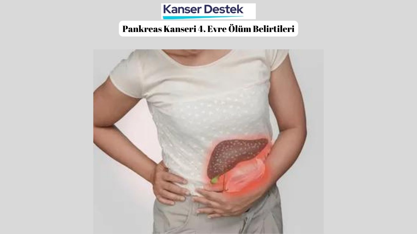 Pankreas Kanseri 4. Evre Belirtileri Listesi!