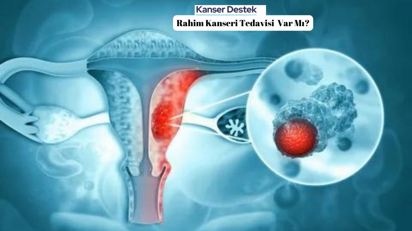 Rahim Kanseri Tedavisi Var Mı? Nasıl Kurtulunur?