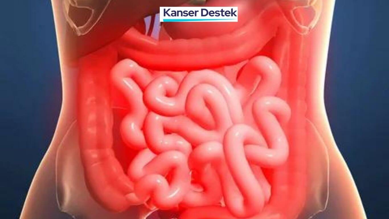 Bağırsak Kanseri Testi Tek Çizgi Nedir? 7 Önemli Neden!