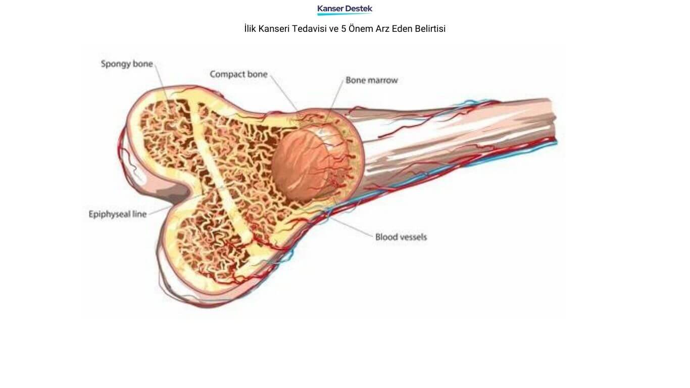 İlik Kanseri Tedavisi ve 5 Önem Arz Eden Belirtisi
